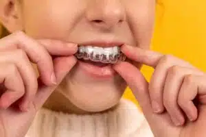 Invisalign tips